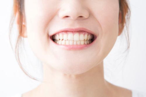 歯を磨いた後に出てくる口の中の白い膜は何 新潟市で歯周病に取り組むwhiteberryわしざわ歯科